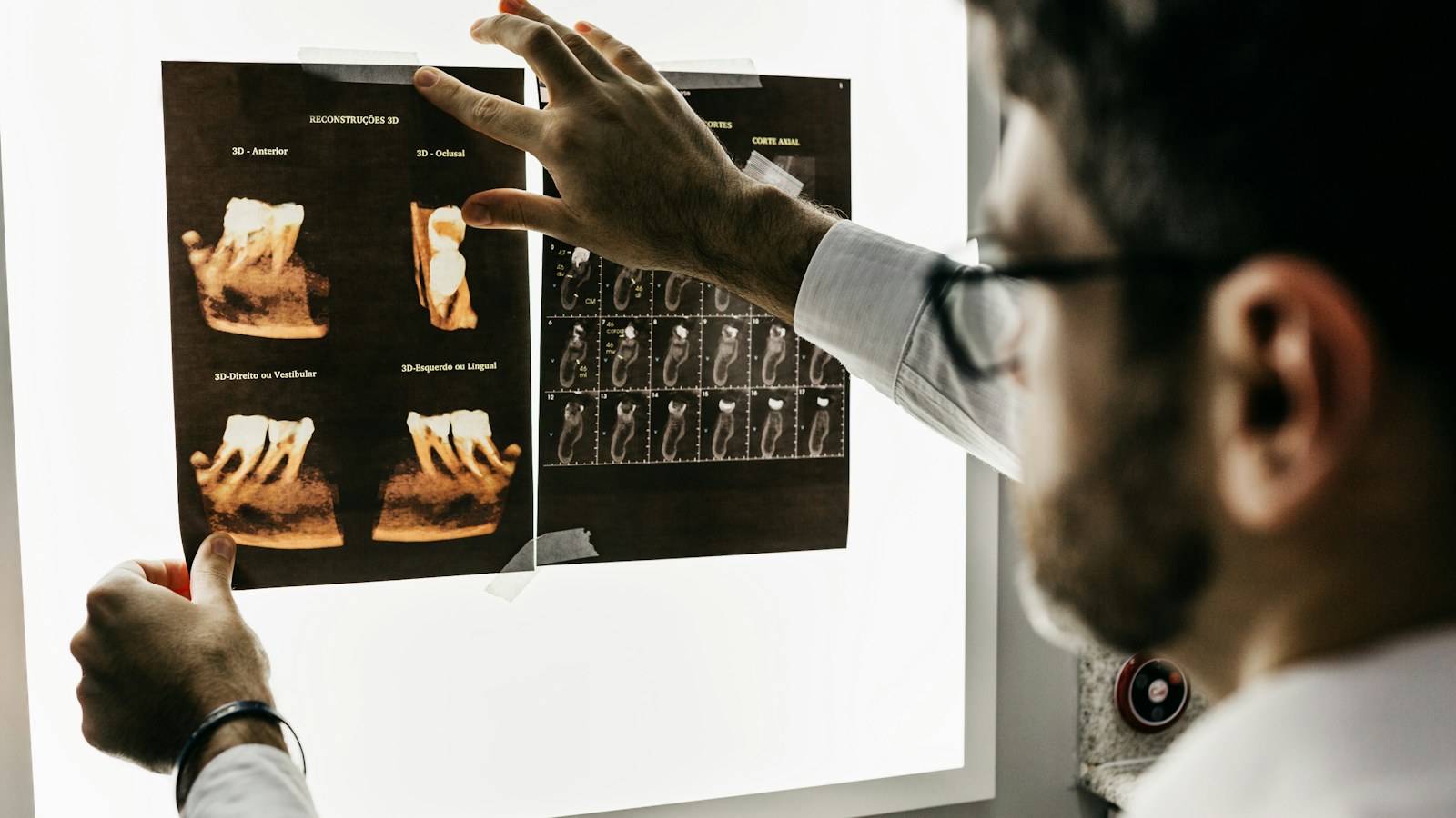 A dentist examining dental x-ray scans on a bright light box
